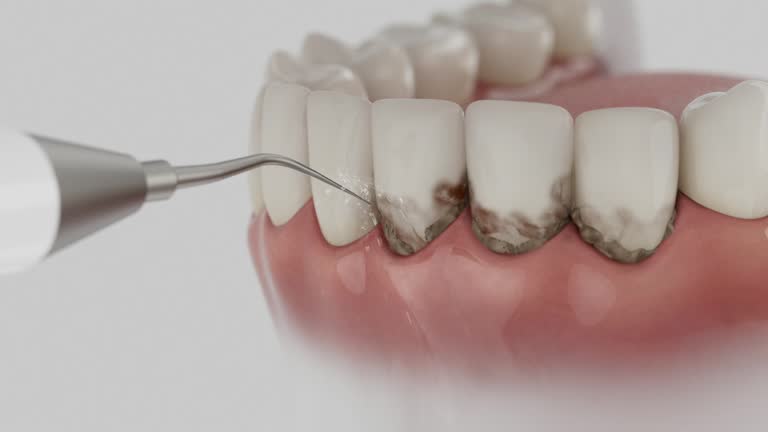 Trusted Root Canal Treatment service in Westville, OK - Dentist Open Now